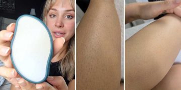 This ‘Magic’ Eraser Removes Unwanted Hair Without Any Pain