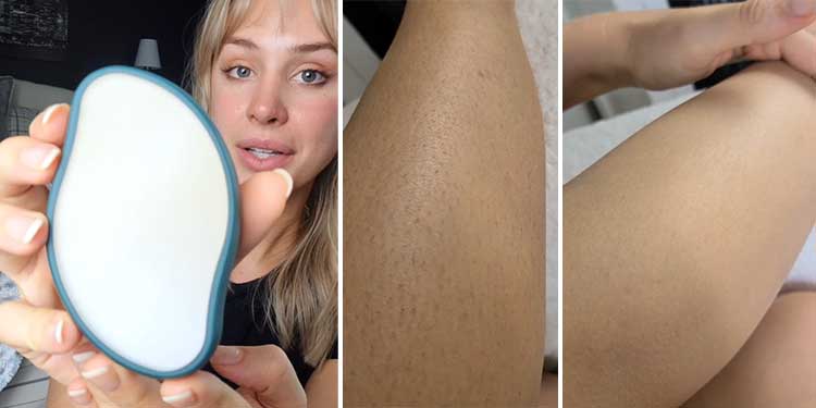 This ‘Magic’ Eraser Removes Unwanted Hair Without Any Pain